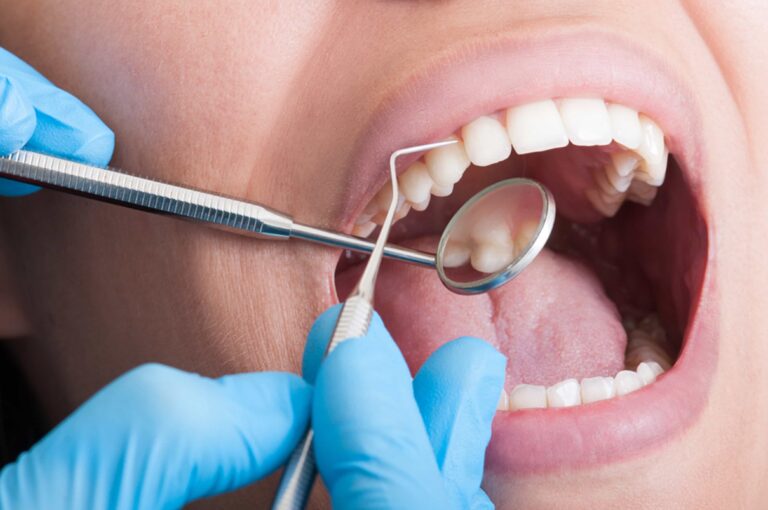 Root canal treatment at Heslington Dental Practice York