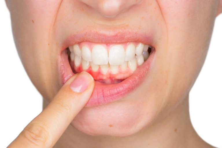 Image – Heslington Dental Practice York