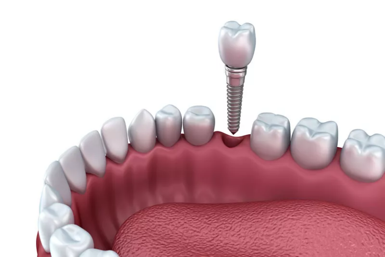 Image – Heslington Dental Practice York