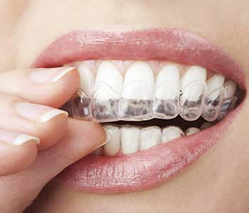 Image – Heslington Dental Practice York