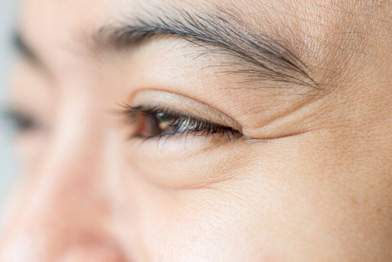 Wrinkles – Heslington Dental Practice York