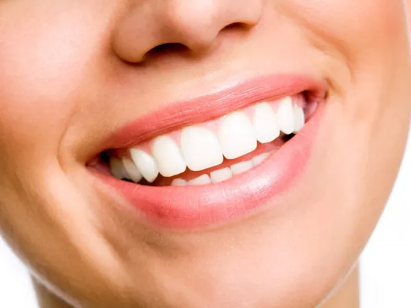 Illustrative close-up of a smile used to represent cosmetic dentistry; not a patient treatment result